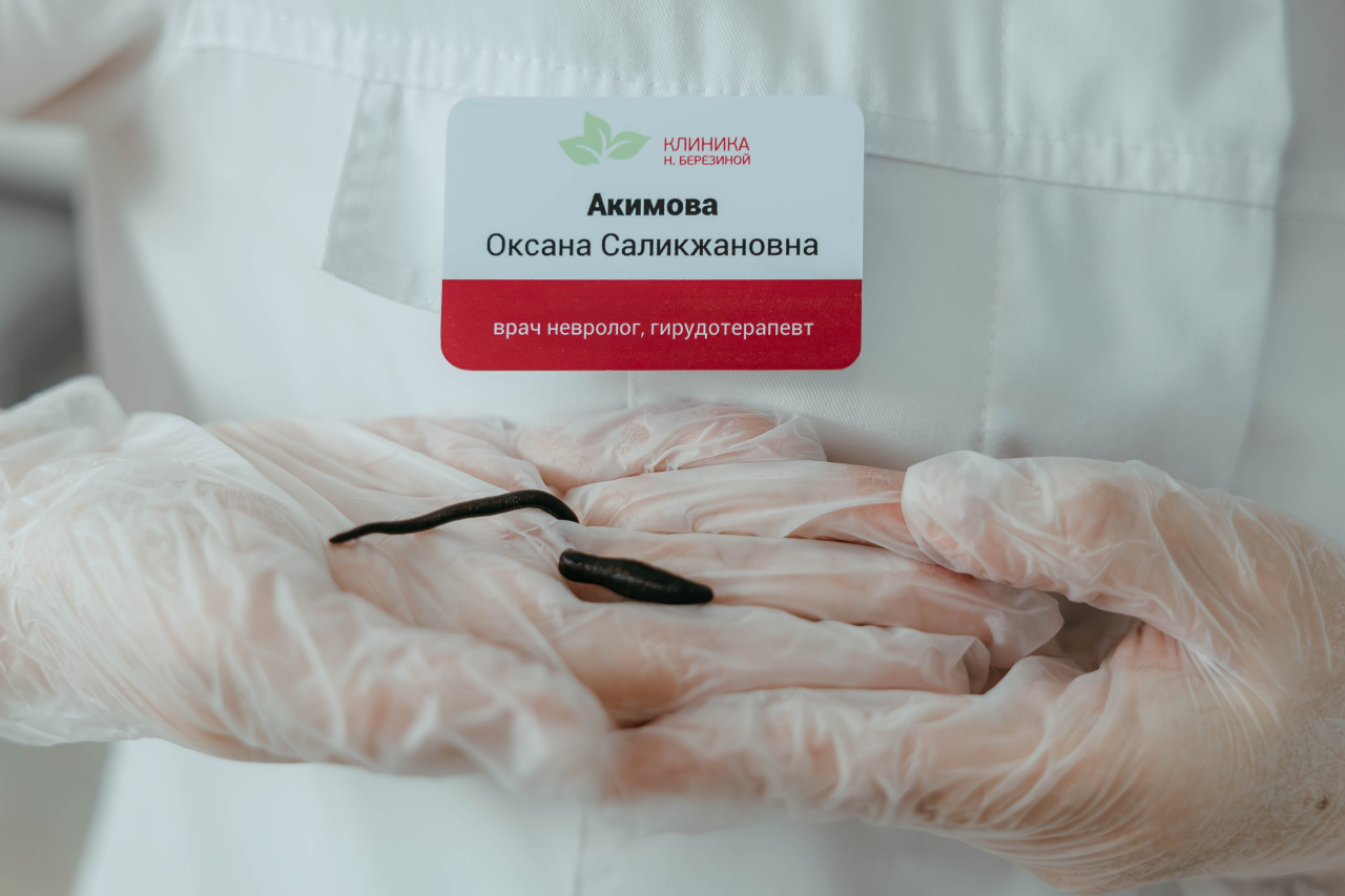 Гирудотерапия в Ульяновске: лечение пиявками в гинекологии, неврологии, дерматологии и ревматологии