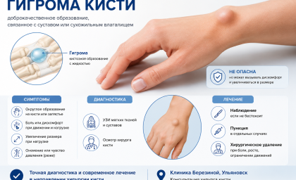 Гигрома кисти