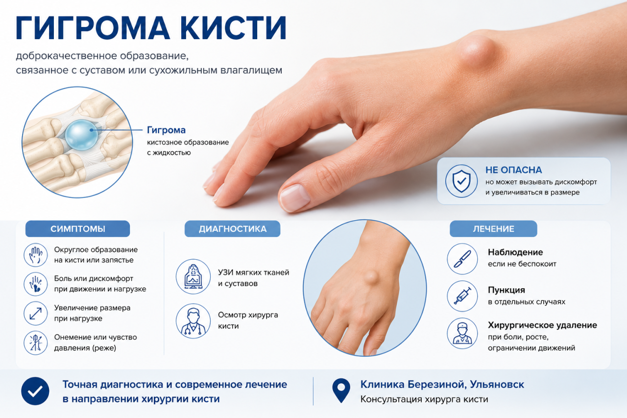 Гигрома кисти